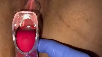 A Gynecologist'S Speculum Examination Leads To A Female Orgasm And Fluid Release